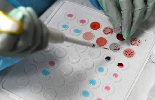 Помогает ли чайная ложка уксуса для похудения