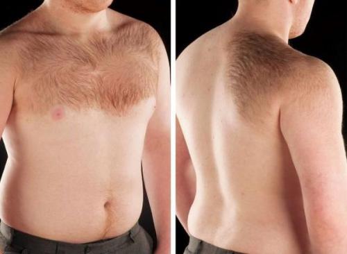 Как убрать пигментные пятна. Пигментация лица: как убрать 03 Как убрать пигментные пятна. Пигментация лица: как убрать 03