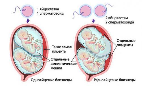 Почему из одного эмбриона получаются близняшки или тройняшки. Виды