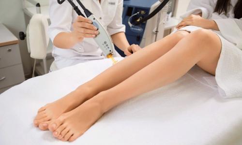 Как работает лазерная эпиляция